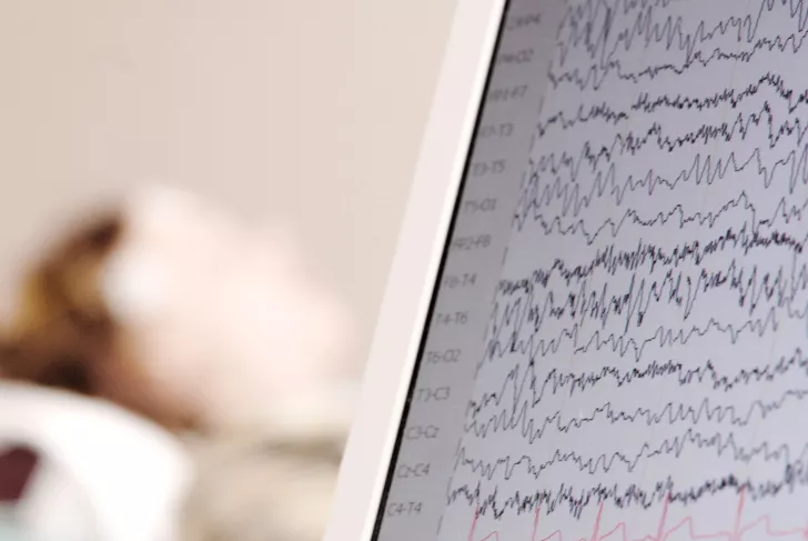 Bildschirm mit Hirnstroemen während eines EEG